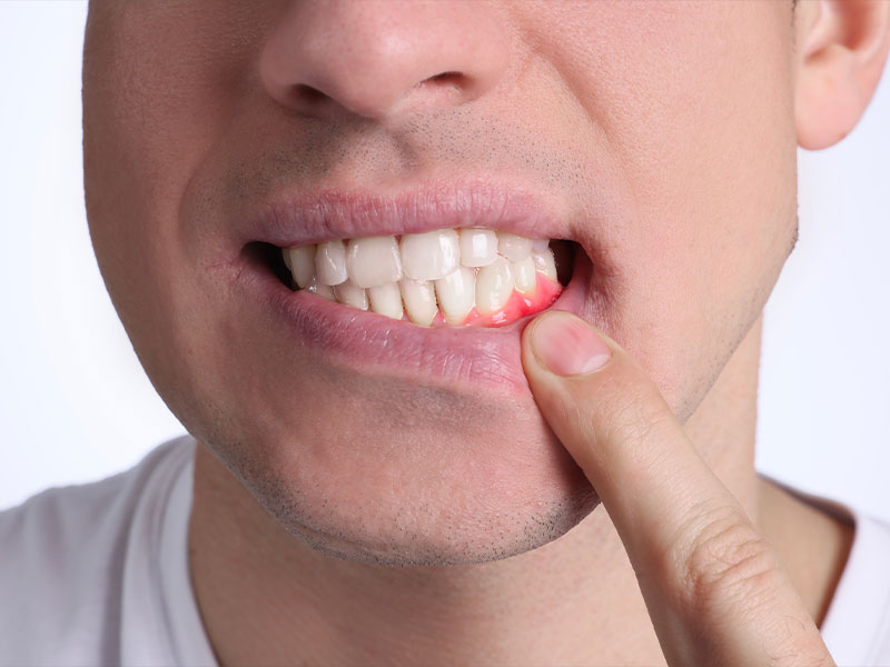 elderly couple smiling